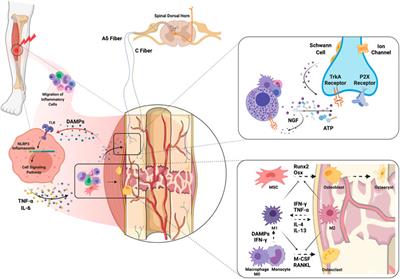 Modeling Complex Orthopedic Trauma in Rodents: Bone, Muscle and Nerve Injury and Healing